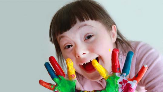 Sindrome Down